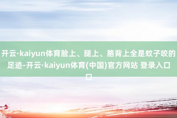 开云·kaiyun体育脸上、腿上、胳背上全是蚊子咬的足迹-开云·kaiyun体育(中国)官方网站 登录入口